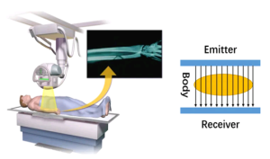 How X-rays Work